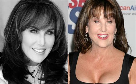 Robin Mcgraw Plastic Surgery Before And After Lip Botox