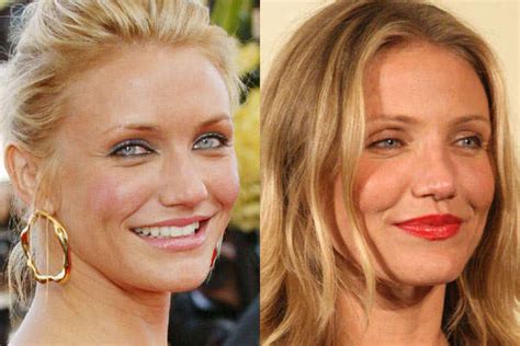 Cameron Diaz Nose Job Plastic Surgery Before And After