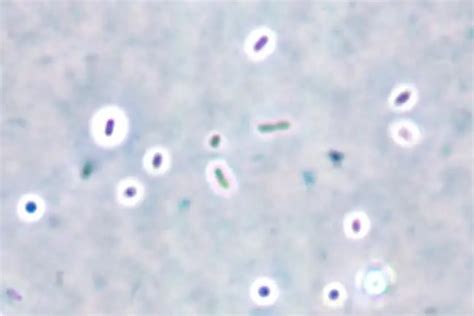 capsule stain principle procedure  results microbeonline