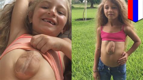 girl born with heart outside chest 8 year old suffers from rare congenital condition tomonews