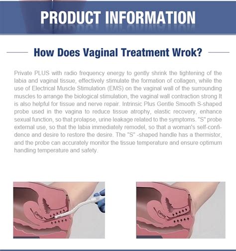 Newest 2018 Rf Vaginal Rejuvenation Vaginal Tightening Machine Buy Rf