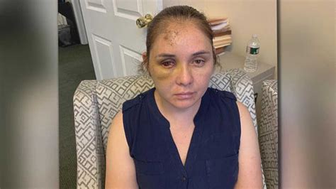 mother allegedly attacked by her son s 13 year old bully