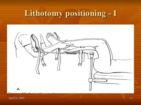 lithotomy positioning  nursing school notes nursing school patient