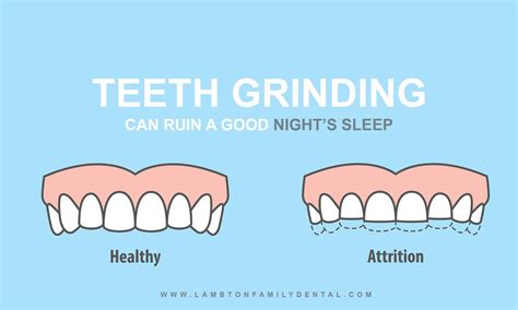 nightly grind teeth grinding  risks cures  bruxism