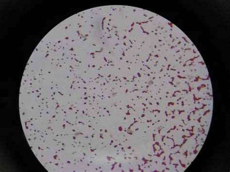 Dvc Microbiology 146 Fall 11 Gard Lab 5 Secondary Stains