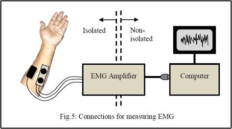 emg equipment  measurement assignment point