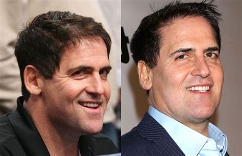 mark cuban nose job plastic surgery     nose job plastic surgery plastic