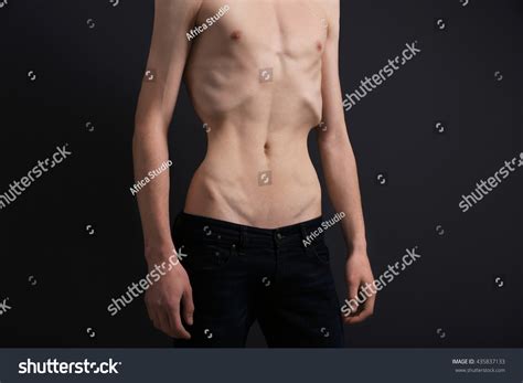 Malnourished Man 287 Billeder Stock Fotos Og Vektorer Shutterstock