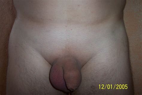 Soft And Small Uncut Cocks 301 Pics 5 Xhamster