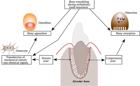 remodelacion osea durante el movimiento dental de ortodoncia formacion osea  hueso