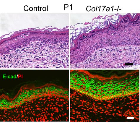 collagen controlling  thickness  juvenile state  skin