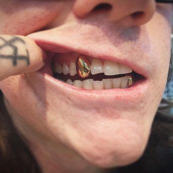 bling gold teeth    reviews jewelry   slauson