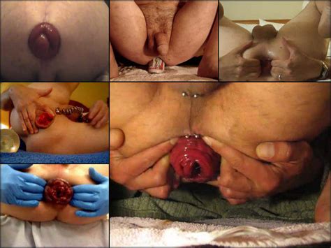 incredible compilation man prolapse anal amateur fetishist