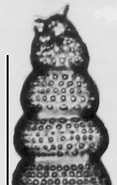 Afbeeldingsresultaten voor "botryostrobus Auritus/australia". Grootte: 117 x 185. Bron: www.radiolaria.org