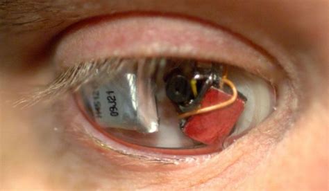 A Man Named Rob Spence Replaced His Glass Eye With A Camera Barnorama
