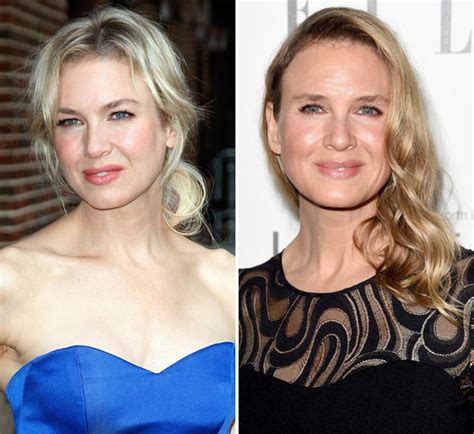 [pic] renee zellweger s face — did she get plastic surgery hollywood life
