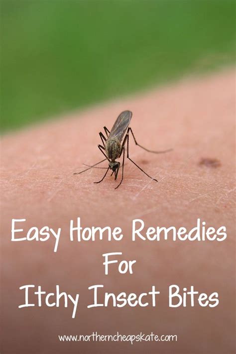 easy home remedies for itchy insect bites insect bites