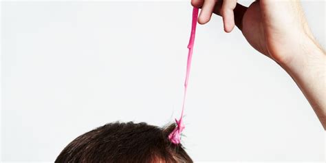 Dr Pimple Popper Pops Bubble Gum Cyst Stuck In A Woman S Hair