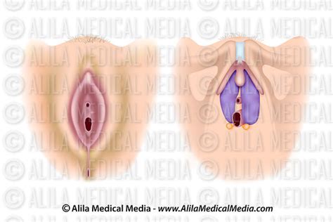 Alila Medical Media Female Vulva Anatomy Unlabeled