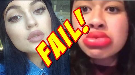 Kylie Jenner Lip Challenge Steps Famous Person