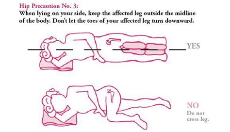 Sleeping Positions After Knee Replacement Surgery Sharon