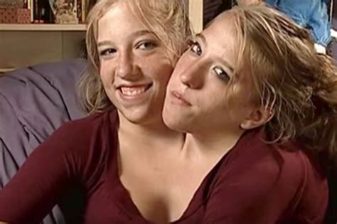 big news from conjoined twins 22 years after their birth la journal