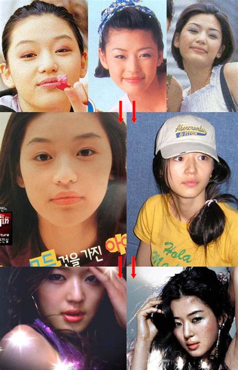 Korean Actresses Before And After Plastic Surgery All