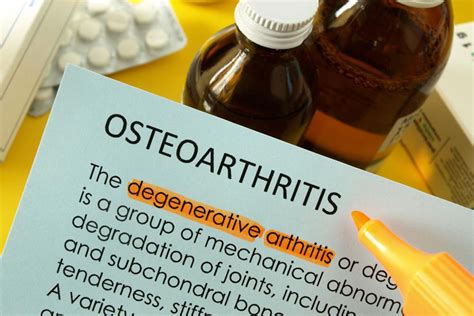 treatment options  osteoarthritis   knee