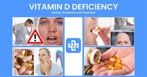 Vitamin D Deficiency Causes Symptoms And Treatment Manage Patient