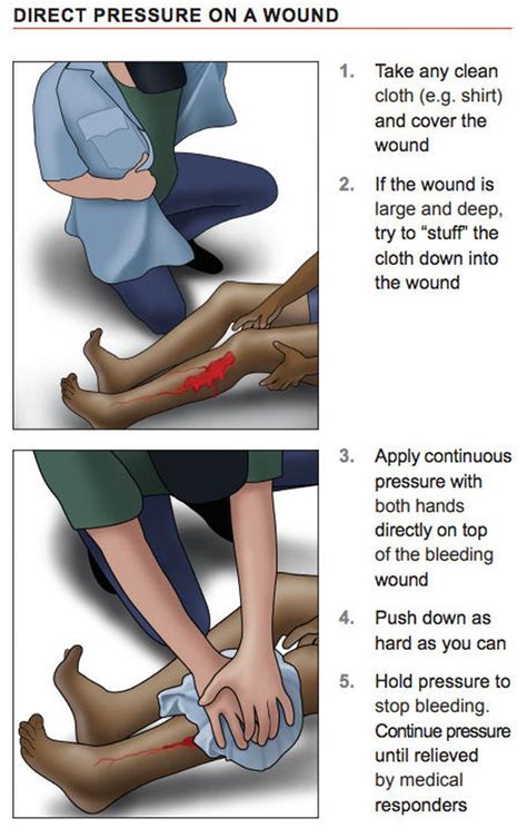 Lessons From A Stop The Bleed Class