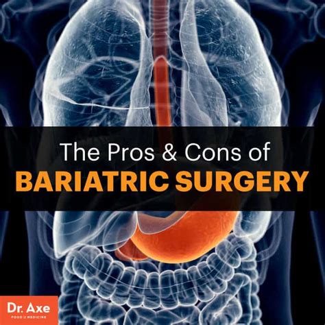 pros cons  bariatric surgery healthier alternatives dr axe