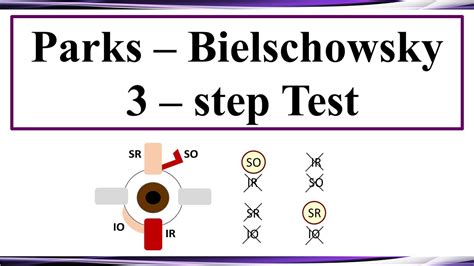 parks bielschowsky  step test youtube