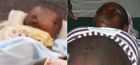 13 yr old girl impregnated by own father gives birth in benin