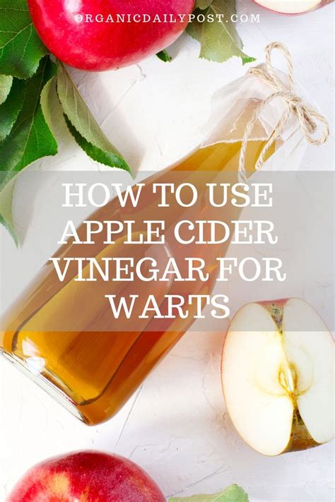 How To Use Apple Cider Vinegar For Warts Natural Cough