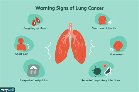 Lung Cancer Symptoms Seven Signs Your Cough Could Be Signalling The