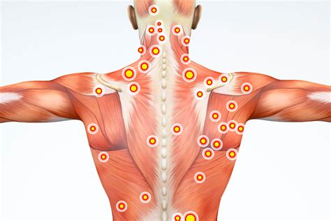 Muscle Trigger Point Pain And Myofascial Release Therapy