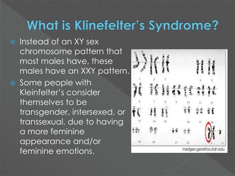 Ppt Klinefelters Syndrome Powerpoint Presentation Id 963511 Free