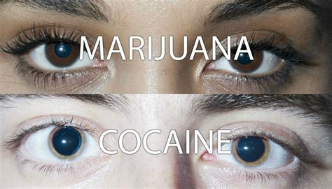 [photos] How To Identify A Drug User By Looking At Their