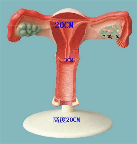 Uterine Anatomy Female Reproductive System Planning Model