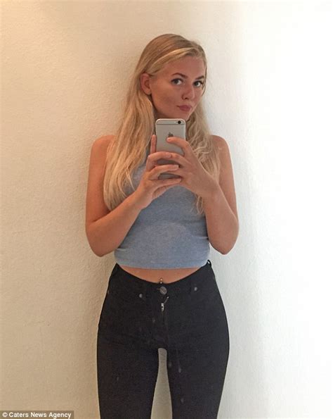 anorexic woman amalie lee charts her recovery with blog posts and