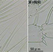 Afbeeldingsresultaten voor "centropages Elongatus". Grootte: 188 x 130. Bron: plankton.image.coocan.jp