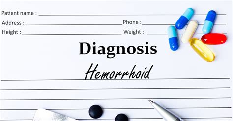 10 causes and complications of hemorrhoids facty health