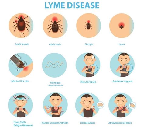 Lyme Disease Outbreak What Are The Symptoms Of Lyme Disease How To