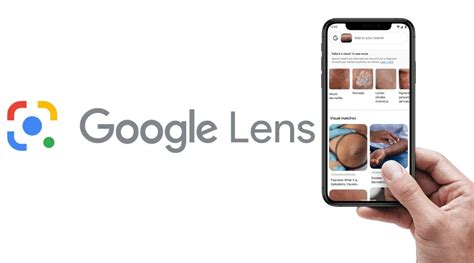 google lens  lets  identify skin conditions  images captured