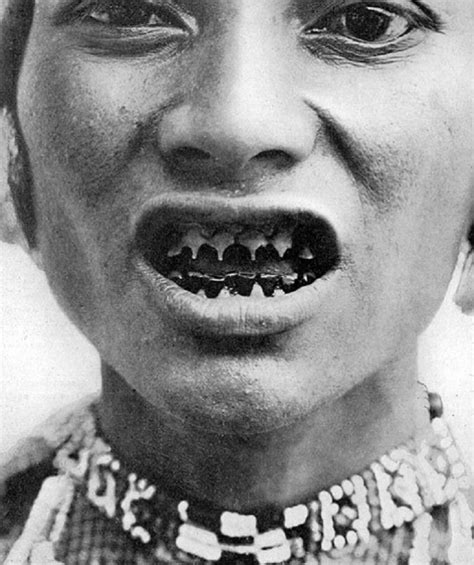 18 Bizarre Ways In Which The World Promoted Extreme Body Modification