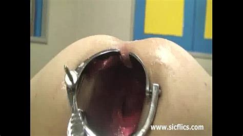 bizarre xxl anal fisting and speculum gape xvideos