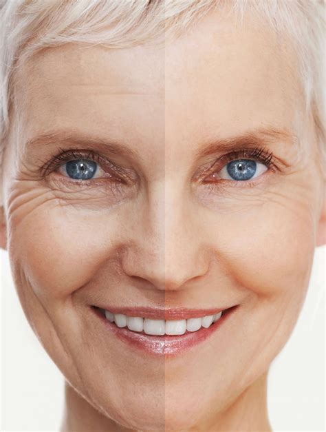 wrinkles  part  aging