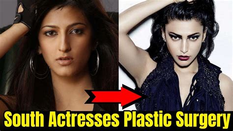 south indian actresses    plastic surgery tamil actress