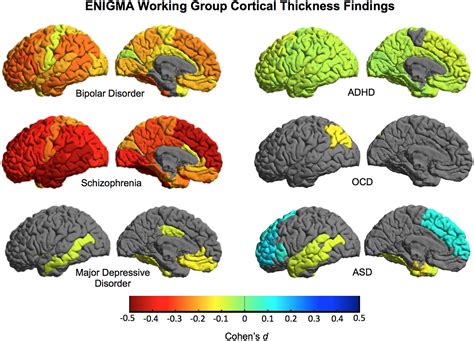 human brain mapping neuroimaging journal wiley  library
