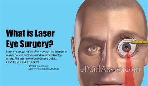 laser eye surgery     precautions     laser eye